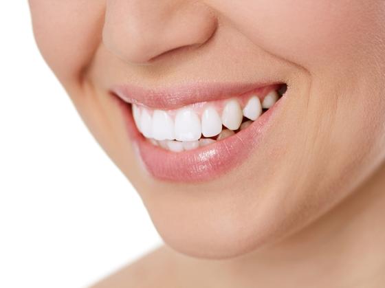 sbiancamento denti prezzo